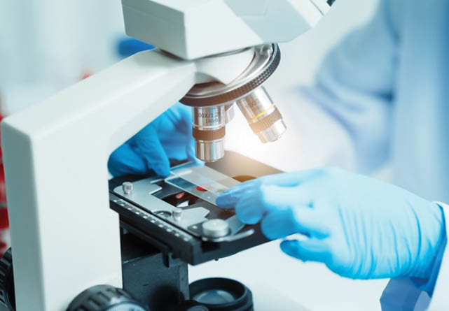 Studiu inovator sugerează noi căi de tratament pentru leucemia mieloidă acută