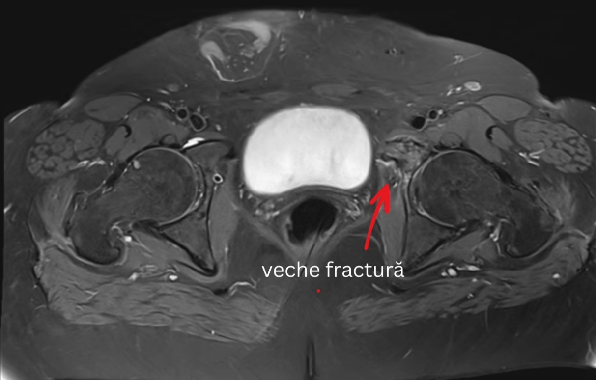 Medical One introduce un RMN inovator cu tehnologie Biomatrix și AI