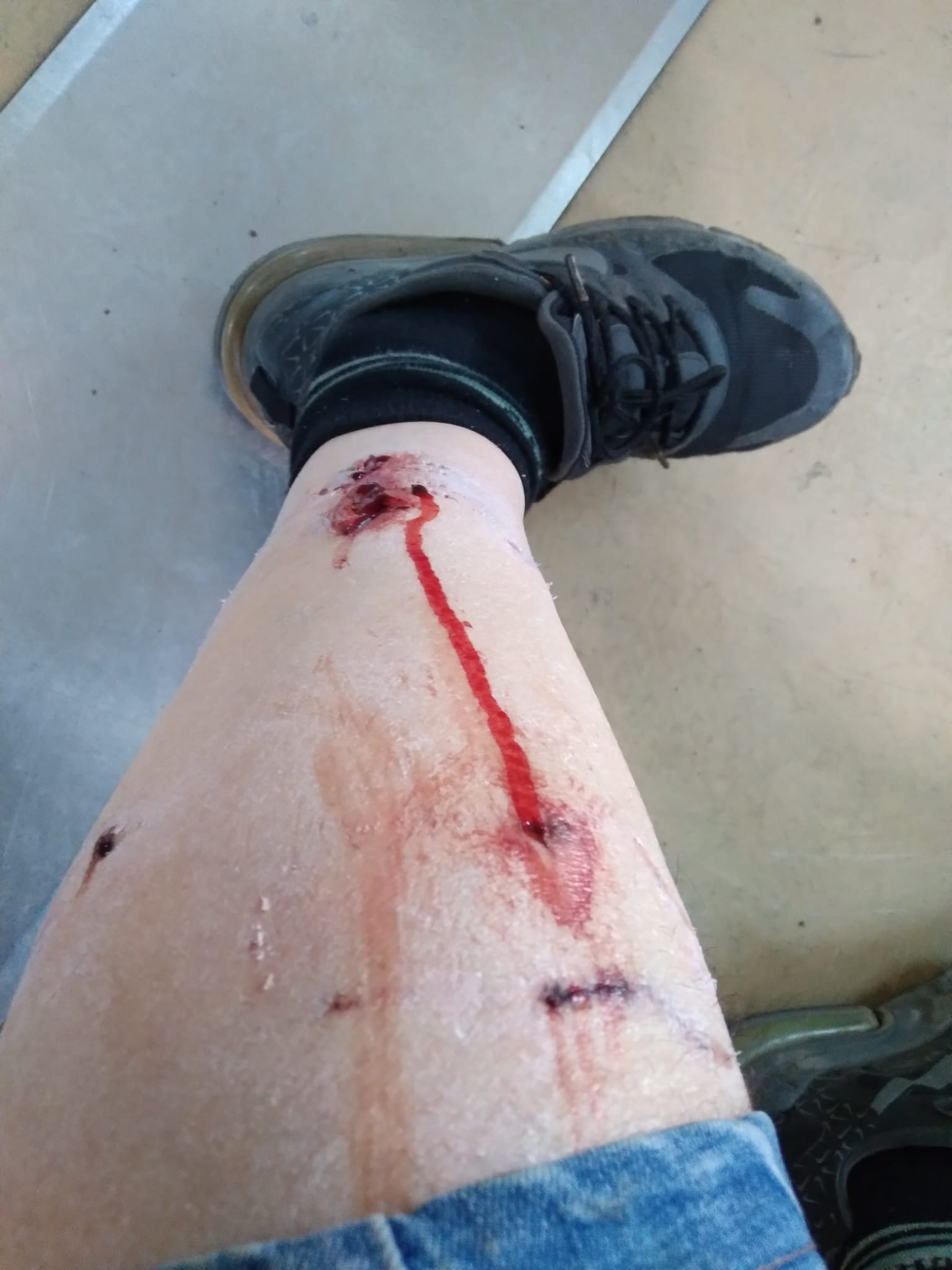 Creșterea agresivității câinilor maidanezi pe platforma Liberty Galați