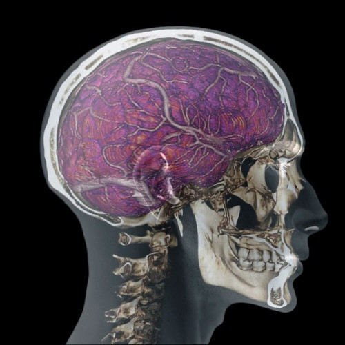 Cum „tuburile craniene” protejează creierul de daune și patogeni