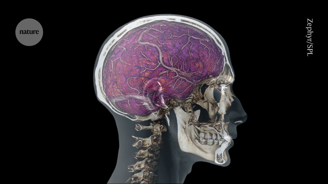 Cum „drainurile craniene” protejează creierul de daune și patogeni