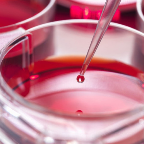 Studii revoluționare asupra leucemiei mieloide acute oferă perspective promițătoare