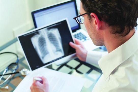 Studiu: Infecțiile fungice severe devin mai agresive în prezența tuberculozei