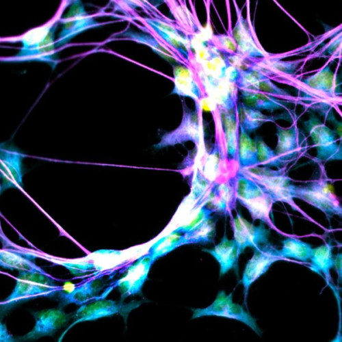 Creierul „super îmbătrânilor” continuă să producă neuroni noi