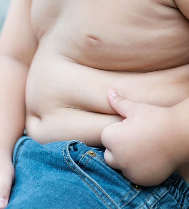 Obezitatea ar putea fi tratată printr-o procedură decontată în premieră în România