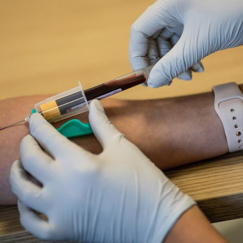 Teste de sânge pentru cancer: sunt peste tot. Chiar funcționează?