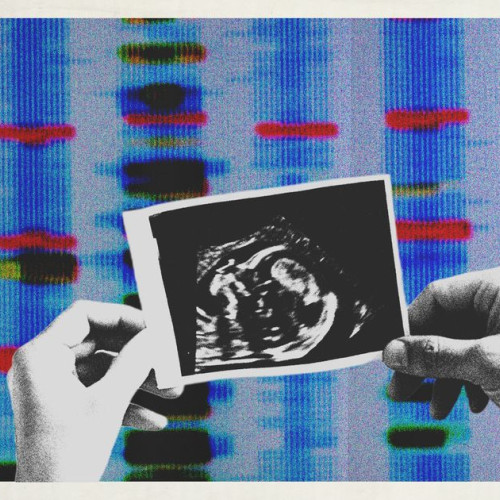 Ce se întâmplă dacă copilul meu moștenește afecțiunea mea medicală?