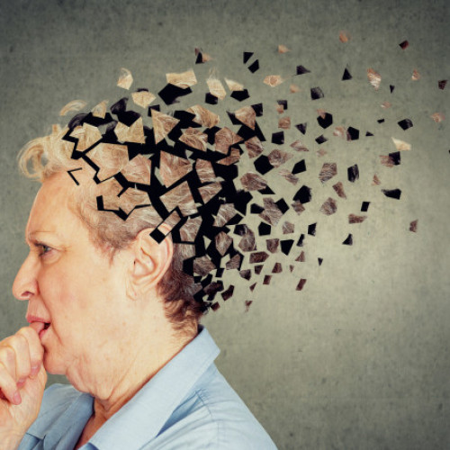 Femeile afectate de Alzheimer progresând mai rapid din cauza unei proteine asociate Parkinson