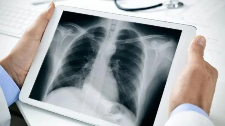 Cluj-Napoca găzduiește „Zilele Spitalului” pentru bolile pulmonare