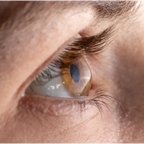 O cornee artificială din solzi de pește ar putea revoluționa tratamentele oftalmologice