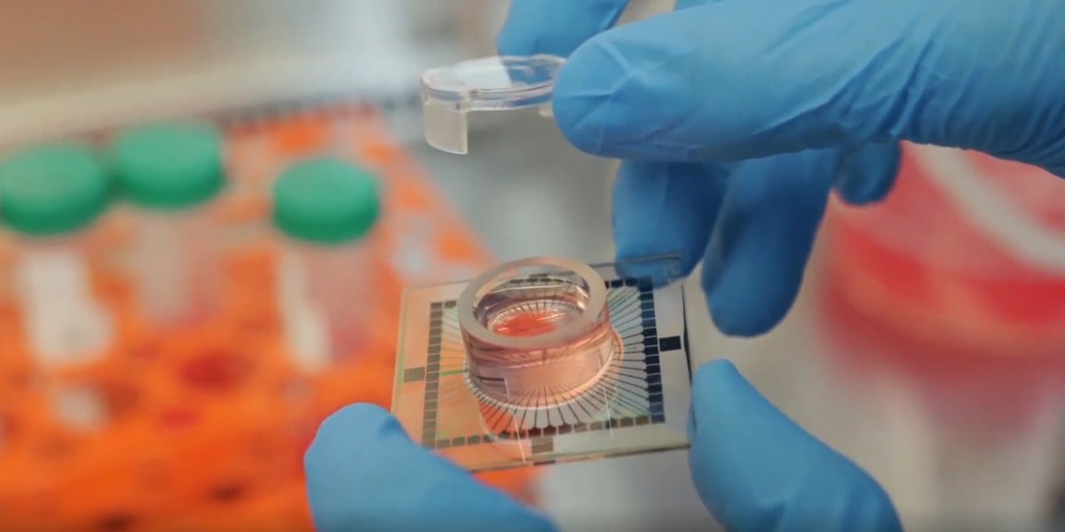 În interiorul centrului de date unde ziua începe cu suplimentarea fluidului cerebrospinal