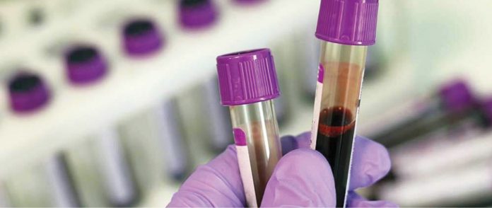 Un nou test de sânge promite depistarea timpurie a cancerului