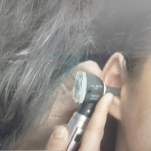 Consulturi ORL gratuite la Spitalul Județean Târgu-Jiu pentru gorjeni