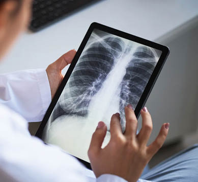 România înregistrează cea mai mare incidență a tuberculozei din Uniunea Europeană