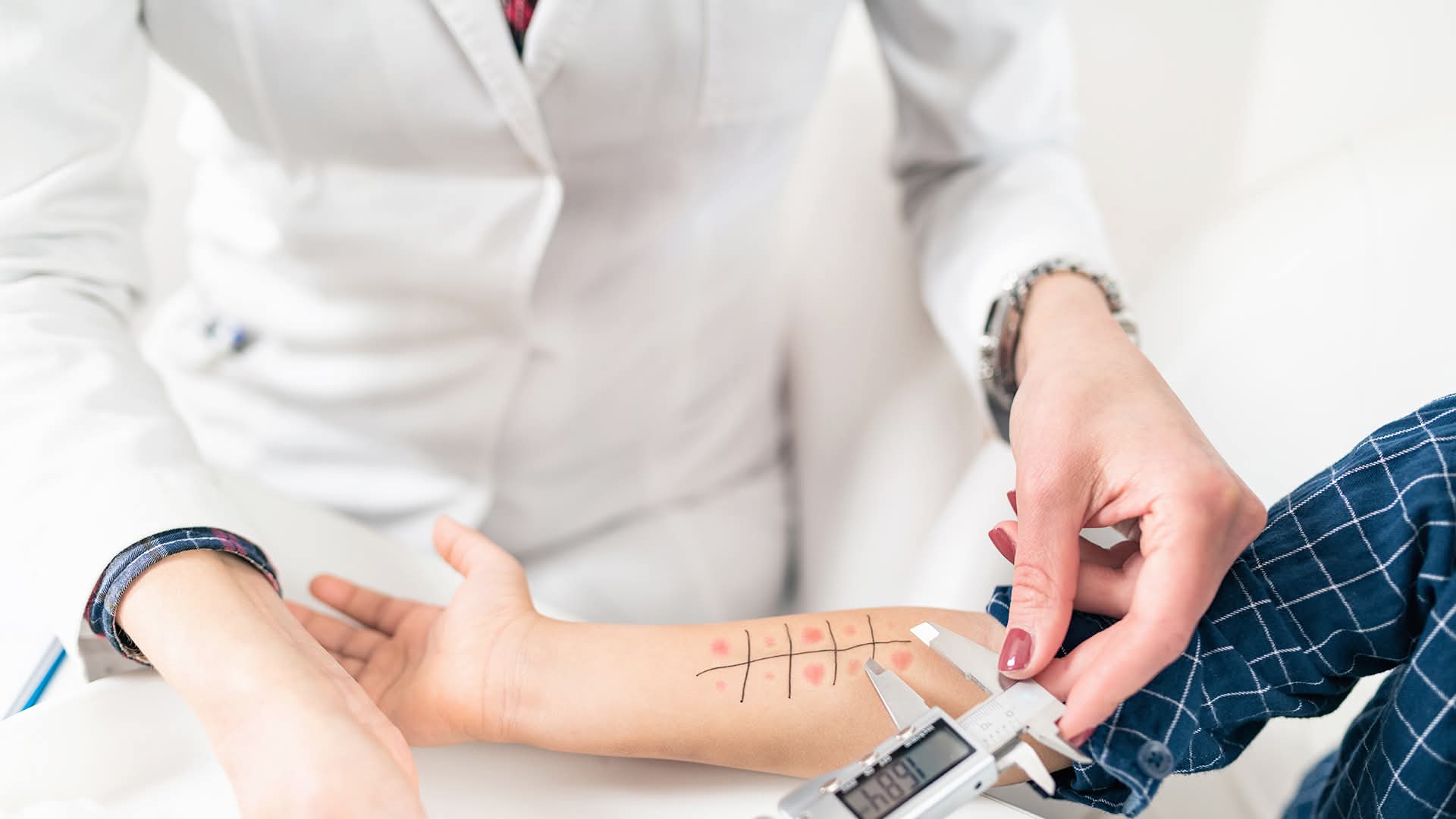 Primăvara aduce o creștere a cazurilor de alergii sezoniere