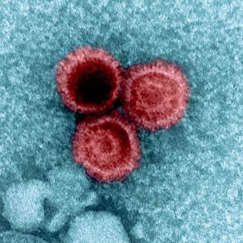 Virusi comuni pot rămâne inactivi în organismul uman, arată un nou studiu