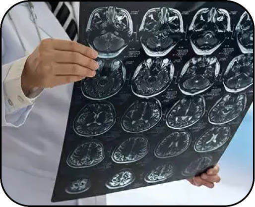 Meningita provoacă anual peste 250.000 de decese la nivel mondial