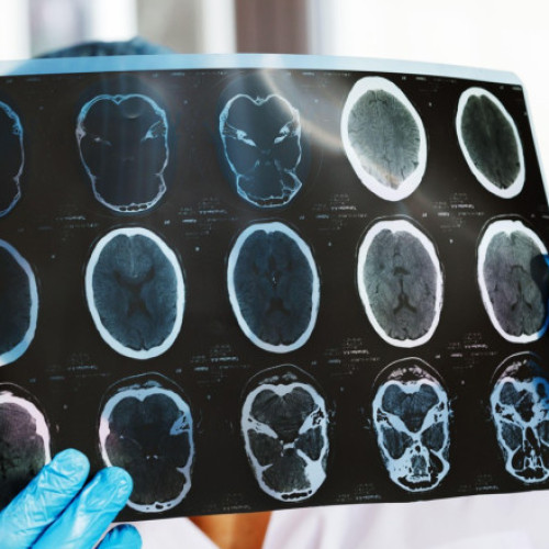 Organizații de pacienți solicită acțiuni urgente din partea Ministerului Sănătății