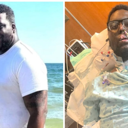 Un tat de 34 de ani suportă sepsis și amputare triplă după o vizită stomatologică