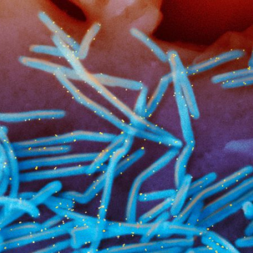 RSV continuă să se răspândească, determinând statele să extindă perioada de imunizare