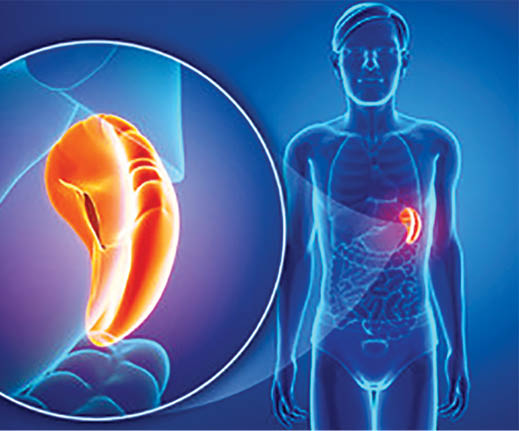Oameni de știință australieni descoperă rolul splinei în inflamația post-AVC