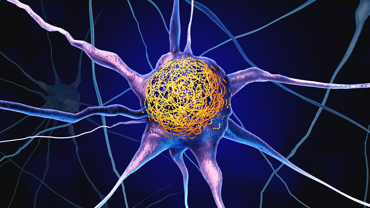 Common Vitamin May Reduce Buildup of Alzheimer's Proteins, Study Finds - ScienceAlert