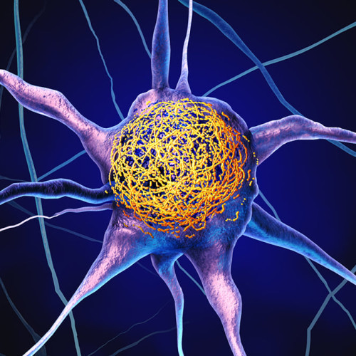 Un vitamin comun poate reduce acumularea proteinelor Alzheimer, arată un studiu