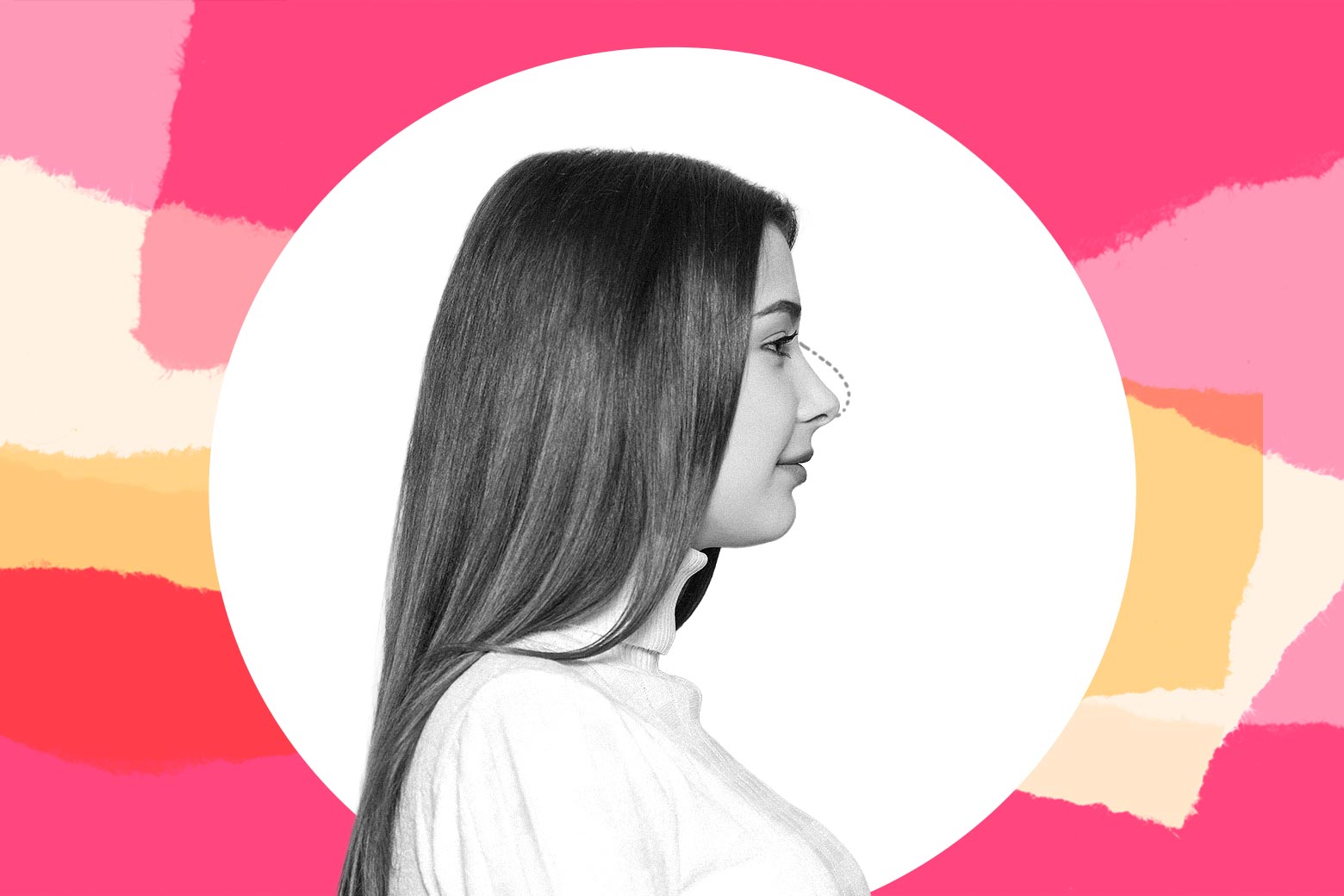 Unchiul a finanțat operația estetică a nepoatei, în ciuda opoziției părinților