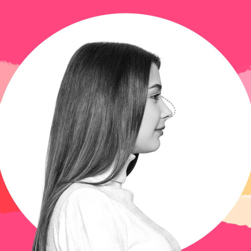 Unchiul a acoperit operația de rinoplastie a nepoatei sale în ciuda voinței părinților ei