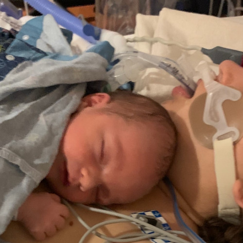 Simptomul înfricoșător care a transformat nașterea unei mame într-o luptă pentru supraviețuire