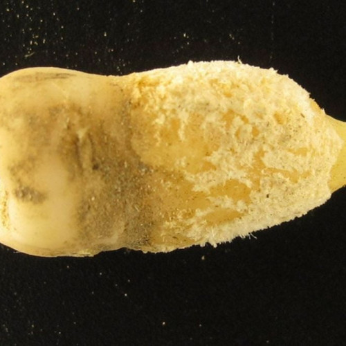 A Bolivian Mummy's Tooth Is Rewriting The History of Scarlet Fever - ScienceAlert