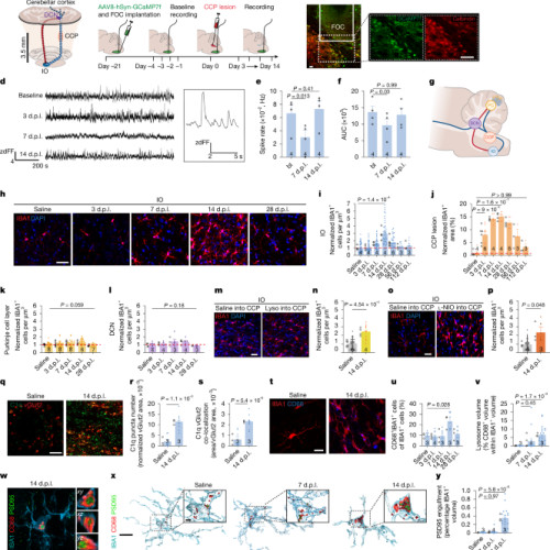 Leziuni focale ale materiei albe determină inflamația materiei gri și pierderea sinapselor