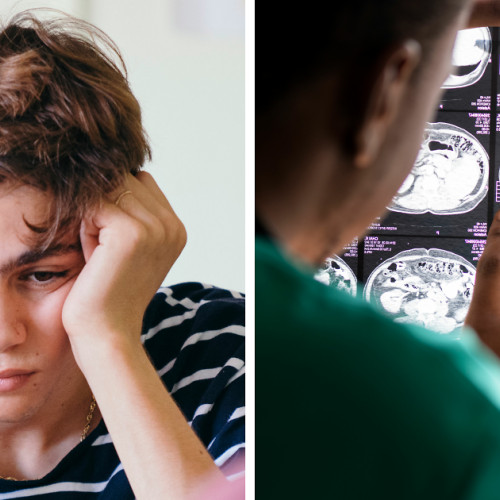 Utilizarea canabisului de către adolescenți poate provoca daune permanente creierului, arată un studiu