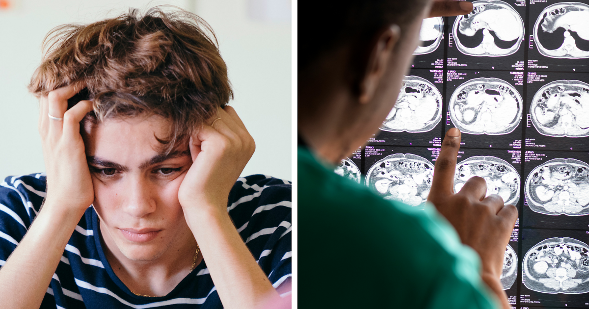 Utilizarea canabisului de către adolescenți poate cauza daune cerebrale permanente, arată un studiu