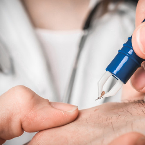 Importanța recunoașterii și prevenirii mușcăturilor de căpușe