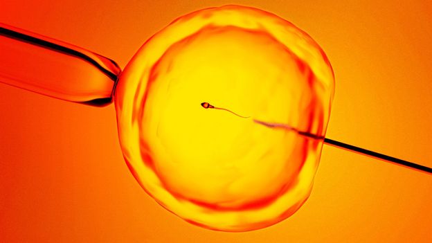 Finding 'hidden sperm': AI offers hope to men previously told they were infertile - BBC