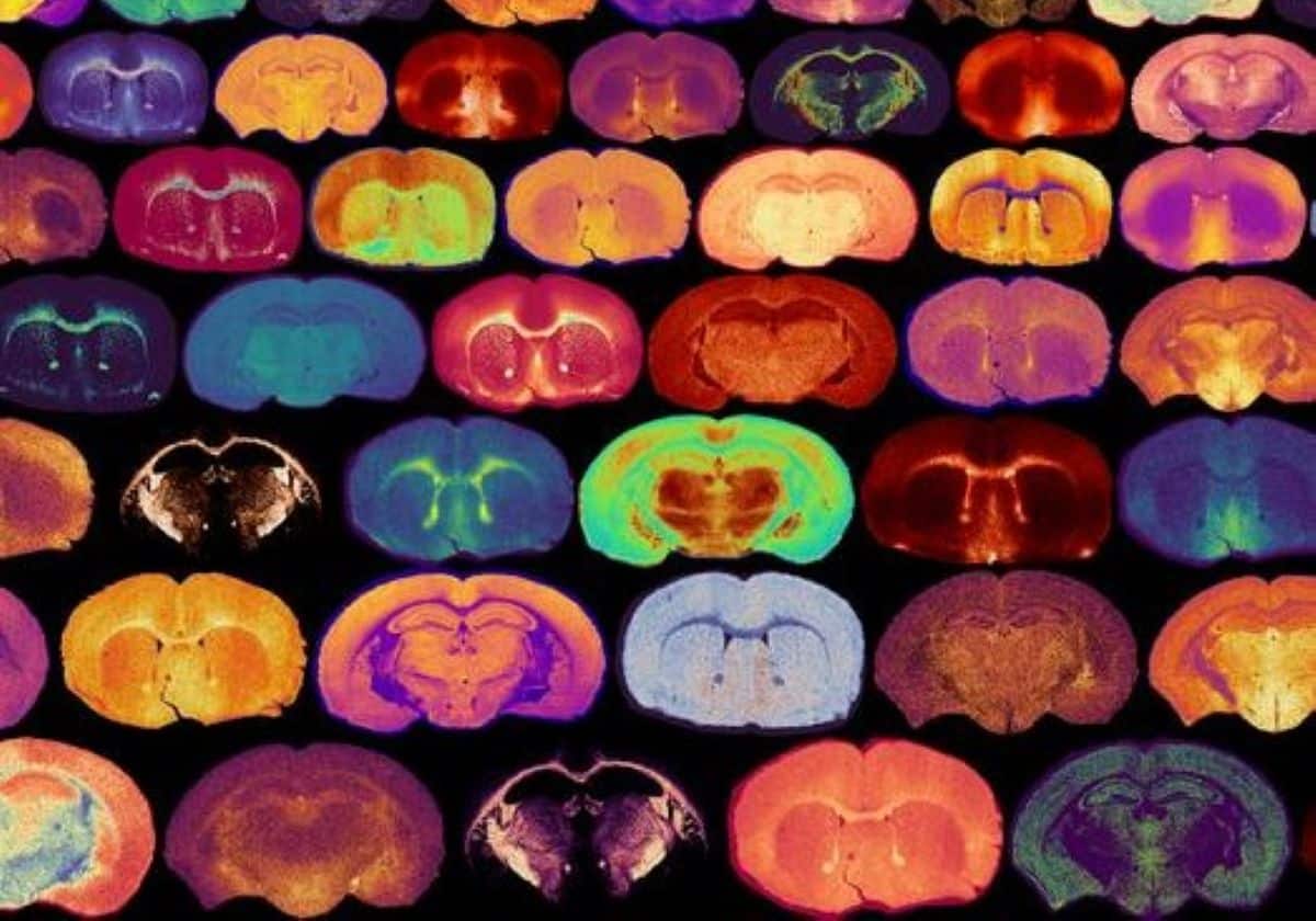 Glucose Levels Signal the Growth of Myelin - Neuroscience News