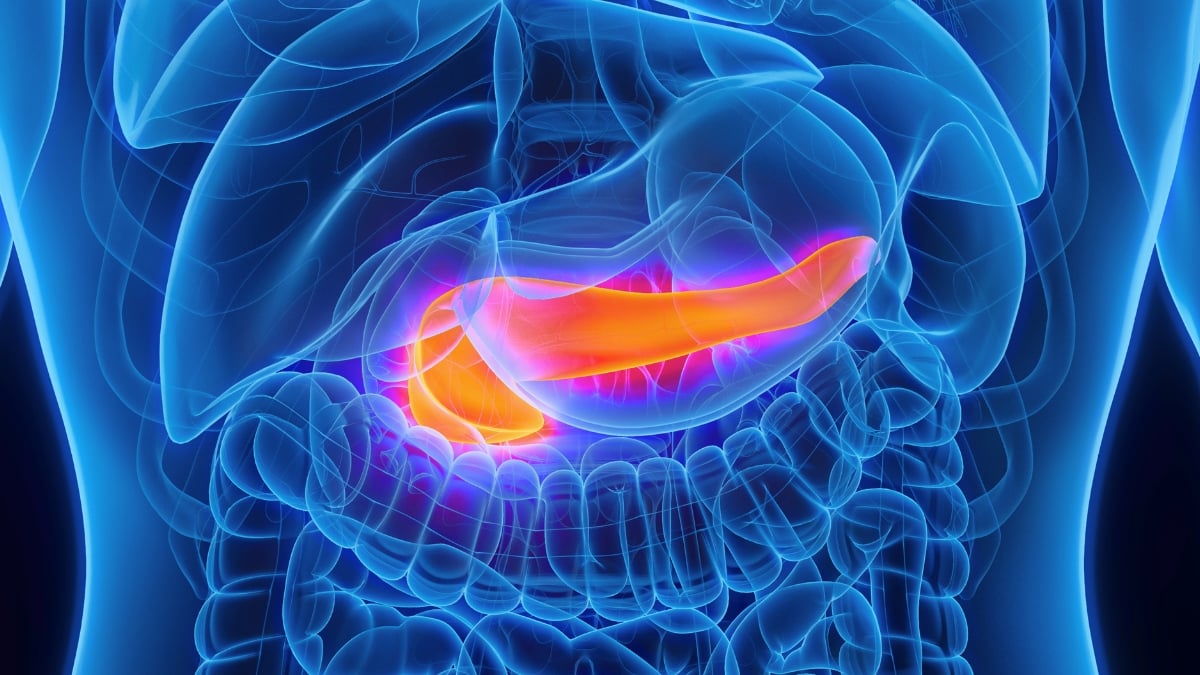 AI Can Spot Pancreatic Cancer Years Before Diagnosis, Study Finds - ScienceAlert