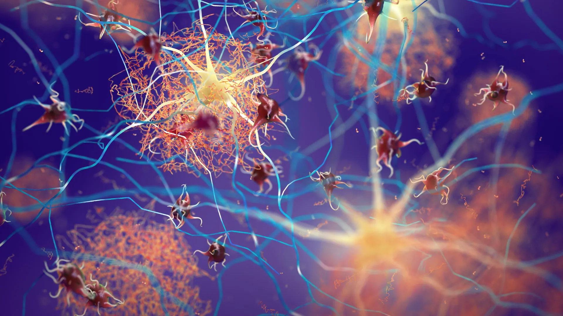 Boosting one protein helps the brain fight Alzheimer’s - ScienceDaily