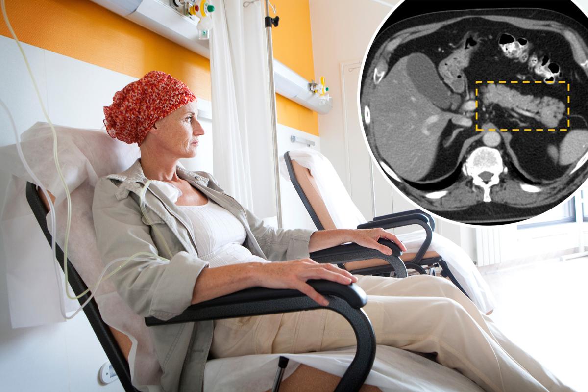 New tool can find deadliest cancer years before tumors can be seen on a scan - New York Post