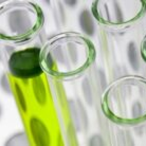 Lista mea de toxicologie publicată de laboratorul DSP Braşov: peste 50 de teste disponibile