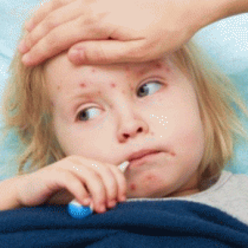 850 de noi cazuri de rujeolă și două decese în ultima săptămână - INSP raportează