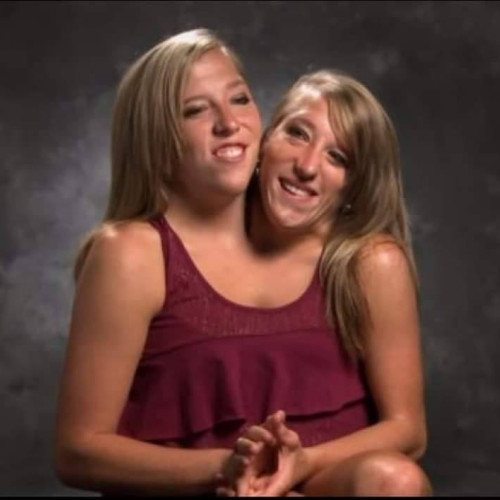 Gemenii Abby și Brittany Hensel, cunoscuți în întreaga lume pentru show-ul lor de la TLC, s-au extins prin căsătoria uneia dintre ele