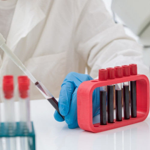 Tot mai mulți tineri fac cancer. Numărul persoanelor sub 50 de ani diagnosticate a crescut brusc cu 80% (studiu)