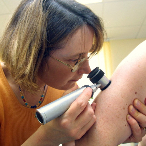 Screening gratuit pentru depistarea precoce a cancerului de piele în Tg. Mureș - Consultațiile au loc între mai și august, fără nevoia de trimitere sau card de sănătate - Medicii avertizează cu privire la creșterea alarmantă a cazurilor de cancere de piele în Mureș - Rezervări disponibile pentru controale dermatologice la Spitalul Clinic Județean de Urgență - Programare la telefon: 0365-430.607.