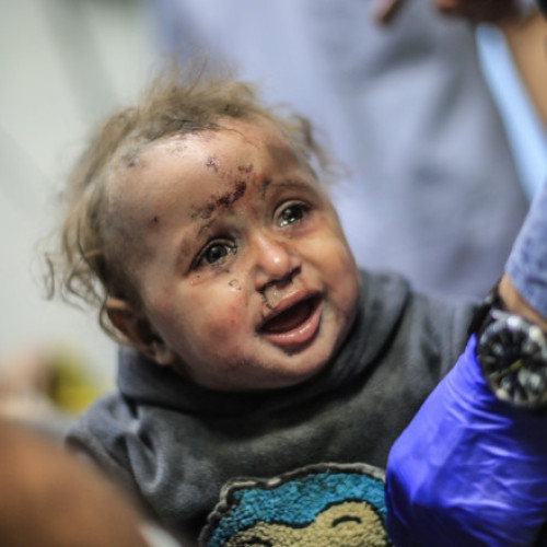 Copii răniți în Gaza aduși în România pentru tratament