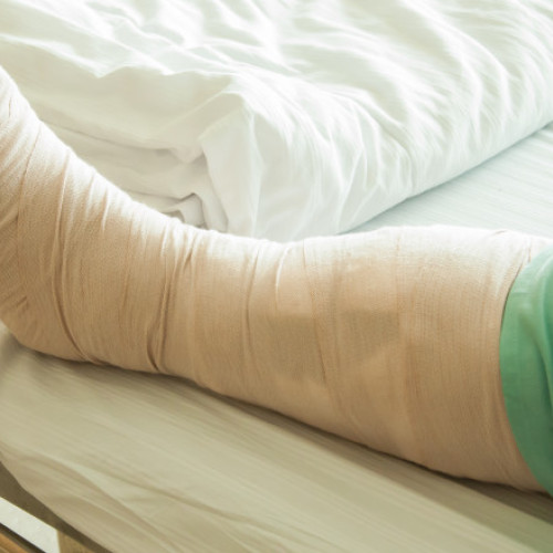 Dezastru la Spitalul din Slobozia: Pacient cu piciorul rupt așteptat 10 zile pentru operație din cauza lipsei de personal medical