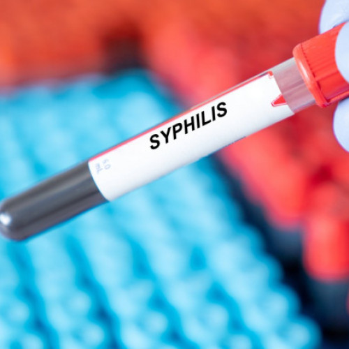 ONG-ul Mondial al Sănătății îngrijorat de creșterea numărului de cazuri de sifilis la 8 milioane pe an. Avertisment în Emisiunea Mijloacelor de Comunicare
