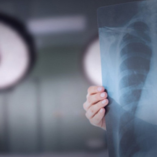 Colegiul Medicilor, despre legea malpraxisului: ”Ministerul Sănătăţii nu a reuşit să realizeze o propunere alternativă”