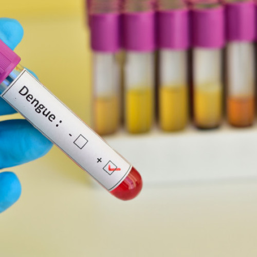 7,6 milioane de cazuri de febră dengue în 90 de țări, inclusiv în Europa. OMS este în alertă: Riscul de răspândire e ridicat